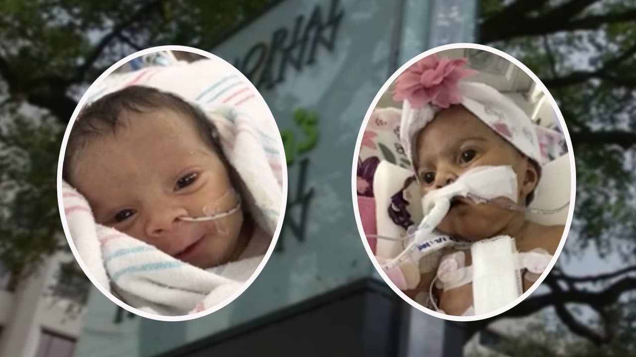 Milagros Menjívar: Médicos dan pocas esperanzas para la bebé de 3 meses en posible caso de negligencia en Houston