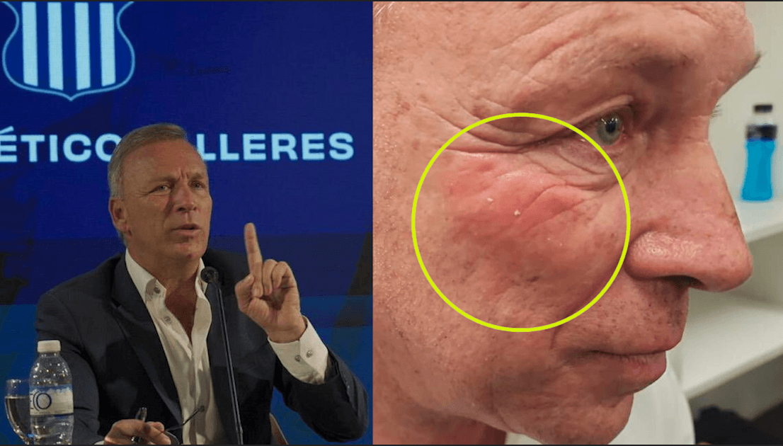 Andrés Fassi denuncia agresión del árbitro Andrés Merlos en Argentina