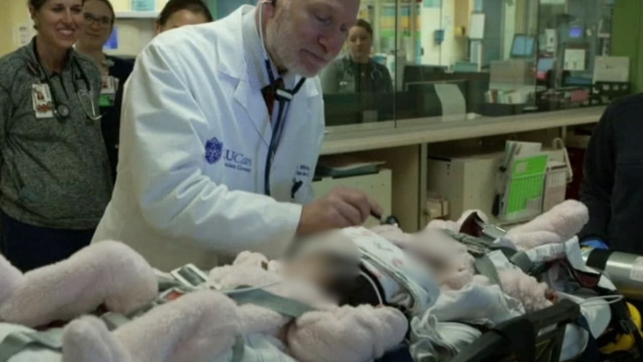Así fue la hazaña médica para separar a dos gemelas que nacieron unidas por la cabeza