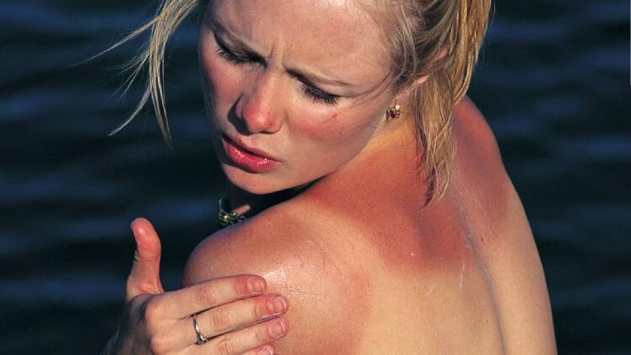 Para ayudar a sanar y calmar la piel irritada, es importante comenzar a tratar las quemaduras por el sol tan pronto como las notes. Y lo primero es 
<b>salir del sol y resguardarse en interiores</b>.