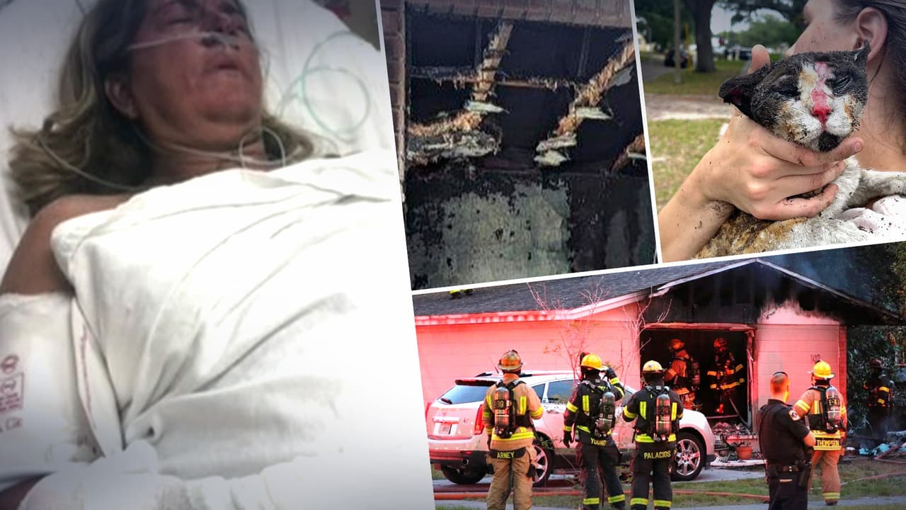 Mujer resulta con graves quemaduras al salvar a sus gatos de un incendio      