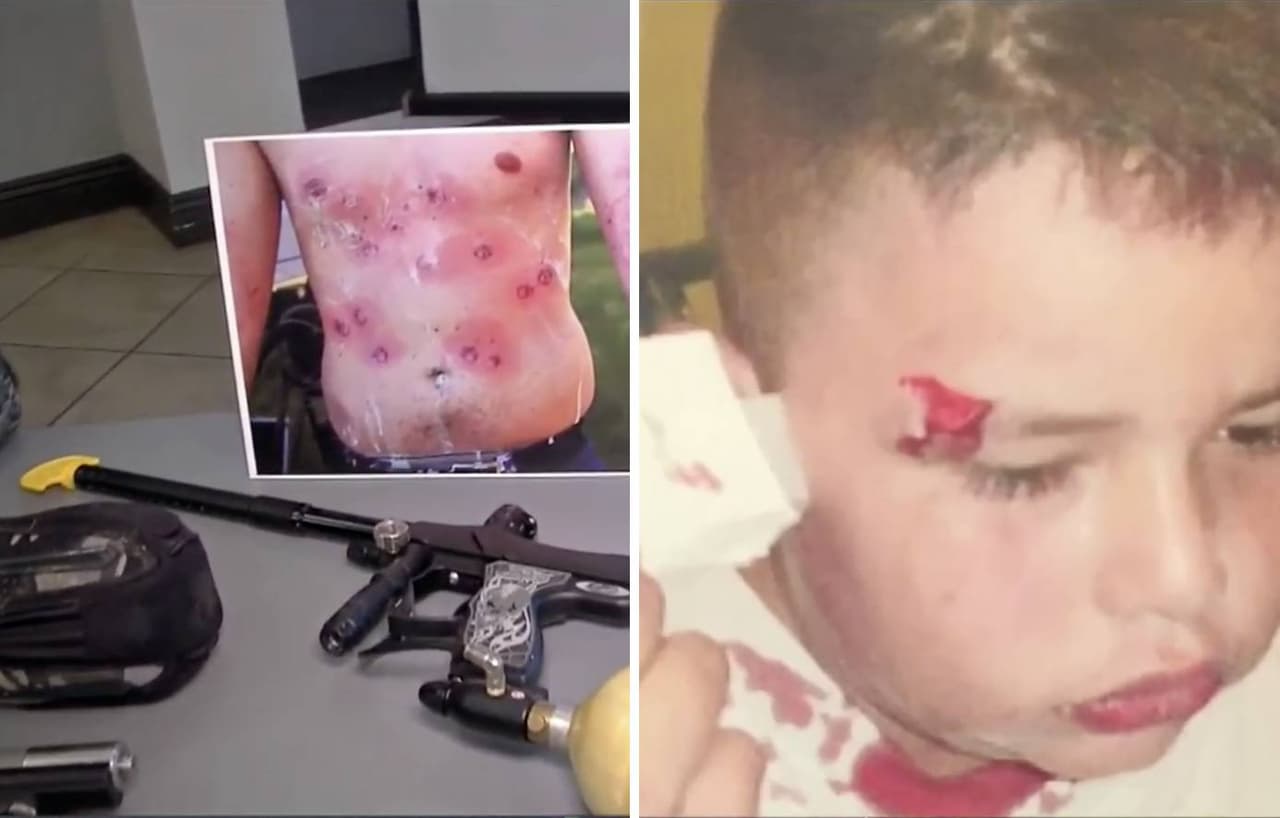 No es un juego: alertan en Los Ángeles por "guerras con armas de pintura" que causan lesiones graves 