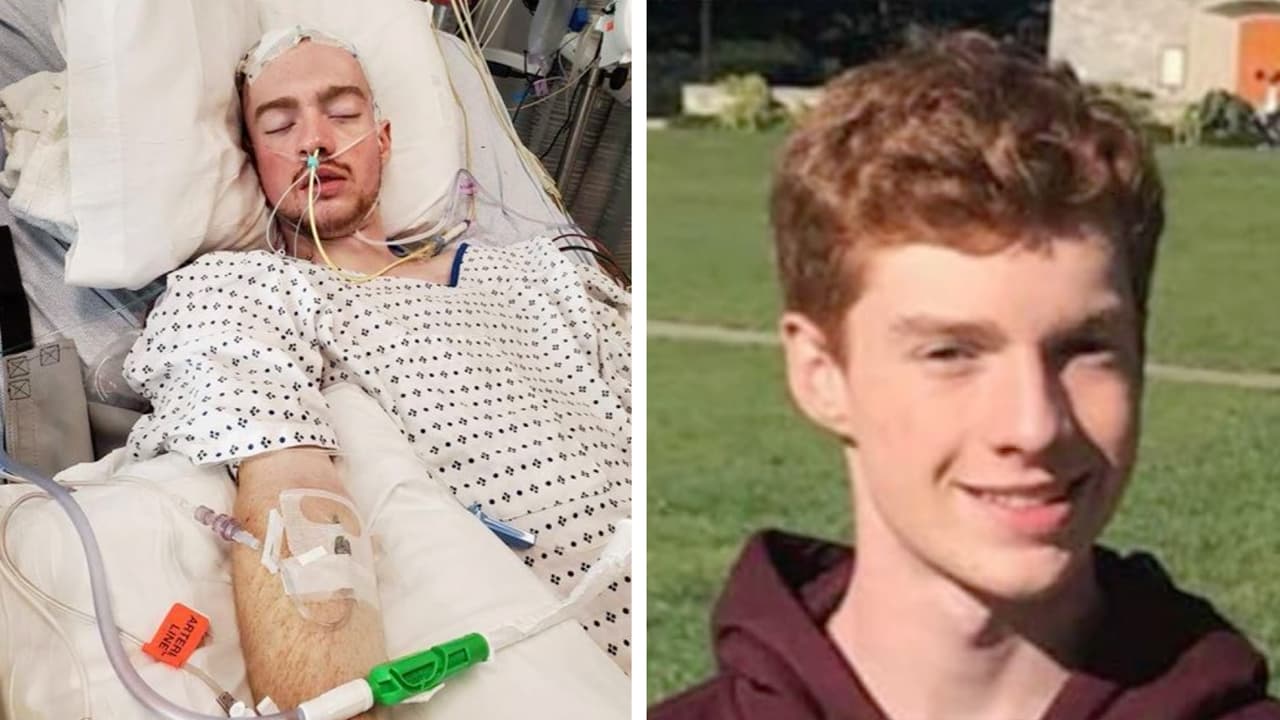 Estudiante de 20 años sufre muerte cerebral: decidió no vacunarse contra el covid-19