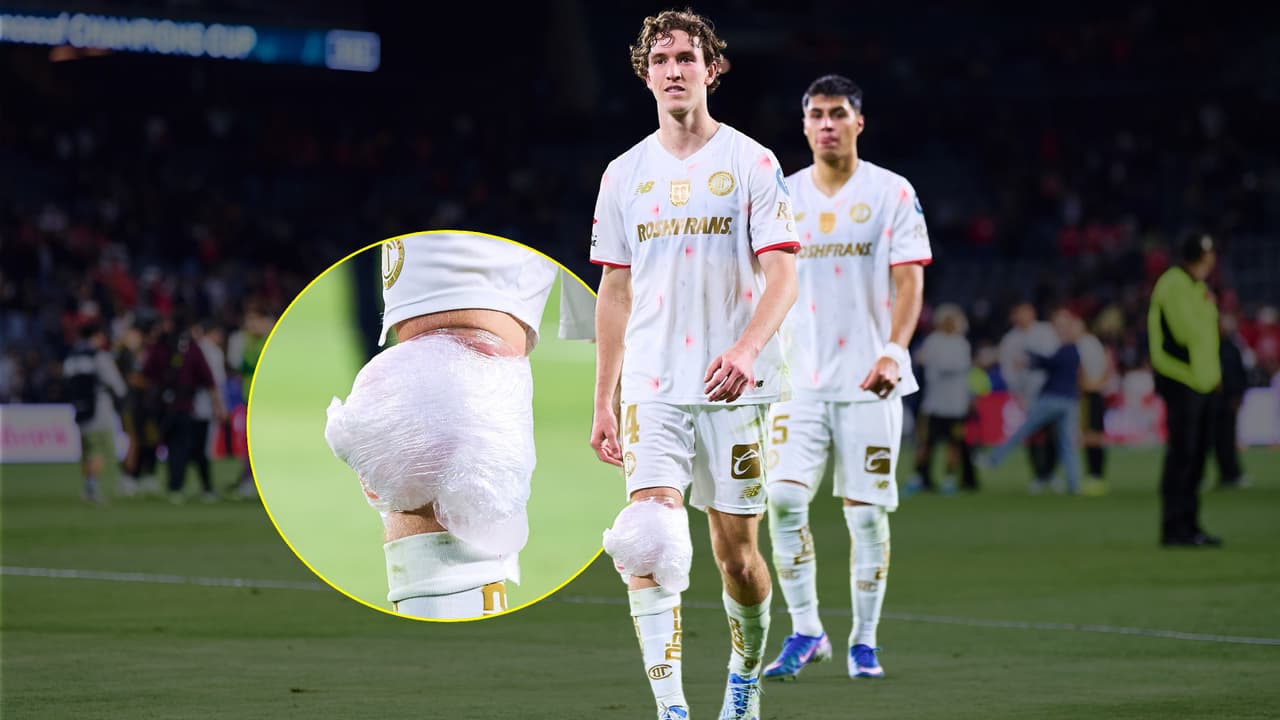 Marcel Ruiz acaba el partido LAFC vs. Toluca con hielo en la rodilla derecha