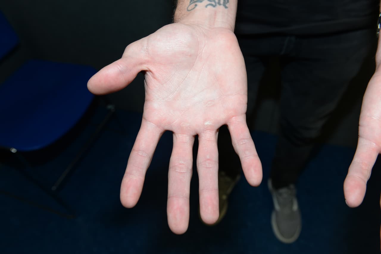 Ambos lados de las manos del actor quedaron registradas en los documentos policiales.