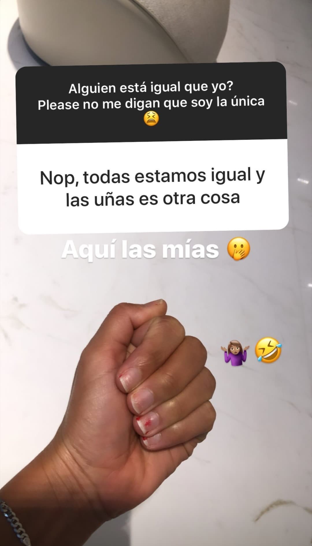 Las uñas de la exreina de Nuestra Belleza Latina también han sufrido estragos y se identifica con las chicas que la siguen en las plataformas digitales.