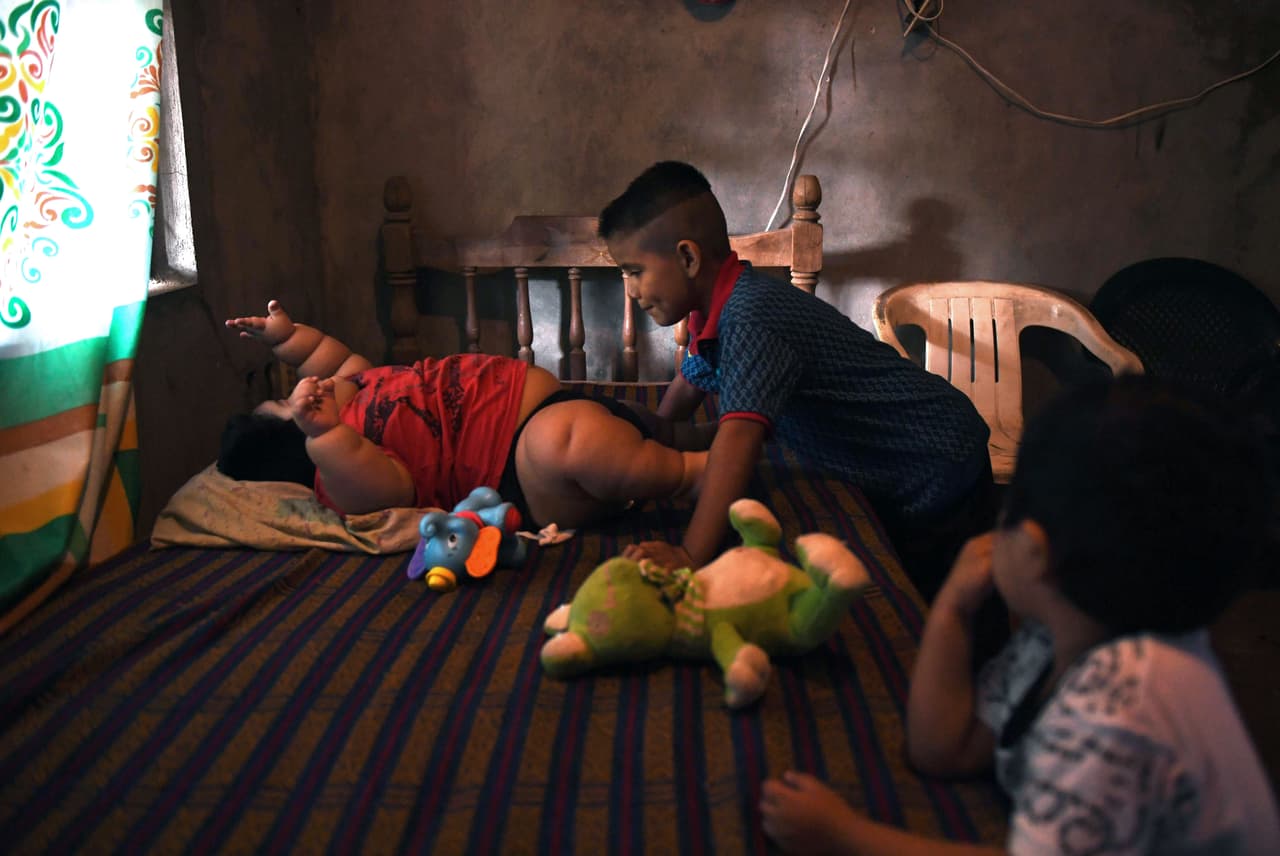 "(El niño) tiene hígado graso, pulmón graso y corazón graso. Su vida corre mucho riesgo pero esperamos estar a tiempo de poder ayudarlo", comentó Orozco a la agencia. Dicen que están aguardando los resultados de muestras enviadas a EEUU.