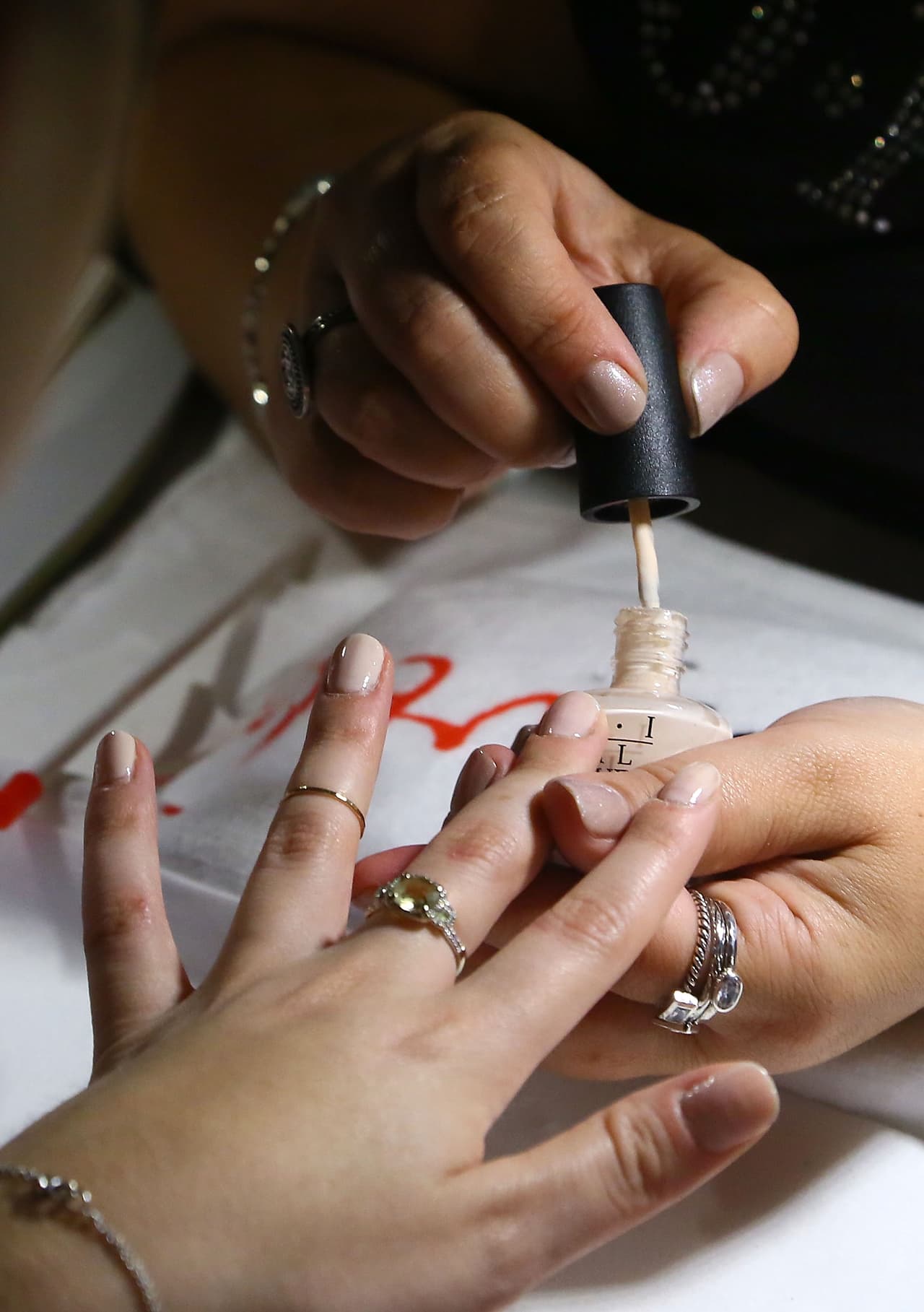 2. Uñas descoloridas. Tendrían algún tipo de onicomicosis (hongo), explicó Ferrer. Si las tienes de color blanco, amarillo o verde, puede ser el resultado de infecciones o problemas en la piel, advierte MedicineNet.