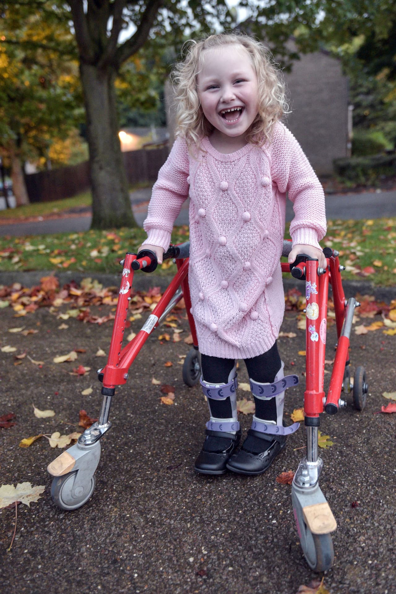 ¡Pero con ayuda del bótox por primera vez es capaz de mover sus músculos!