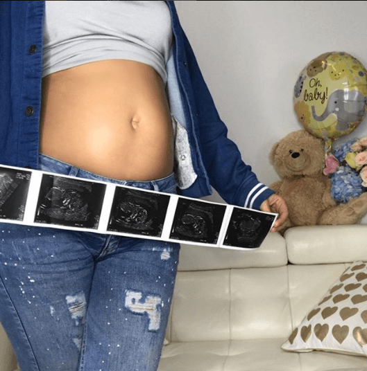 Ese mismo día, Ana Patricia pudo escuchar el corazón de su bebé y destapó en esta foto su pancita, "me sorprendió lo grande y formadito", dijo.