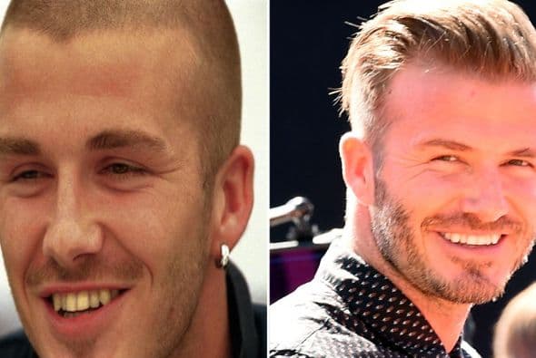 La sonrisa que ahora presume es como para un concurso.