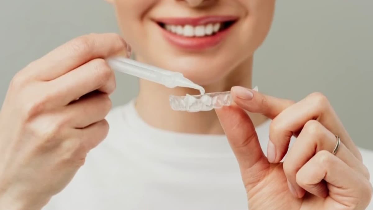 Odontóloga alerta sobre daños irreversibles por trucos dentales virales en redes sociales