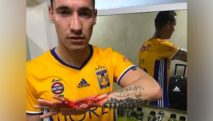 Jesús Dueñas salió herido tras la bronca entre aficionados en el 'Pirata' Fuente