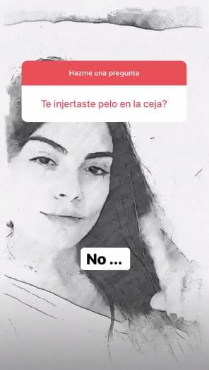 Además, desmintió tener algún tipo de injerto en la ceja.