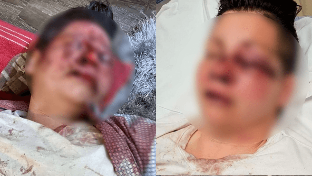 "Cuenca ocular rota y lesiones en la cabeza": Golpean y roban a una mujer en el estacionamiento de un Walmart