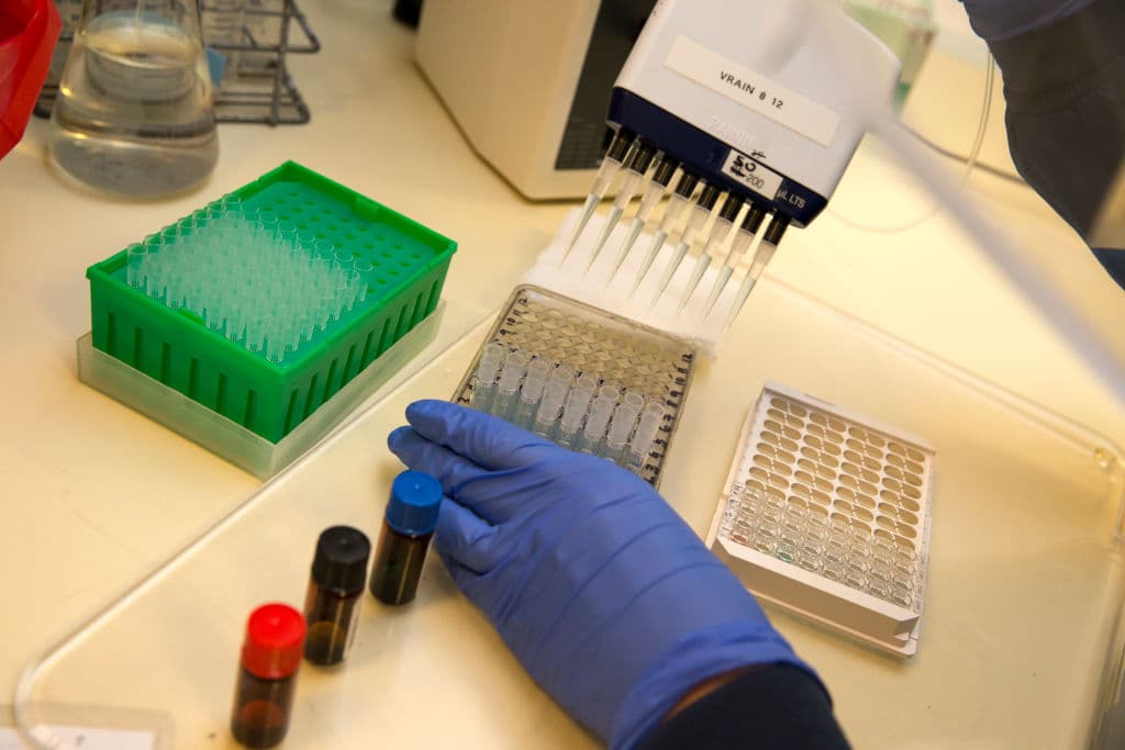 Científicos identifican un anticuerpo humano que impide al coronavirus infectar las células 