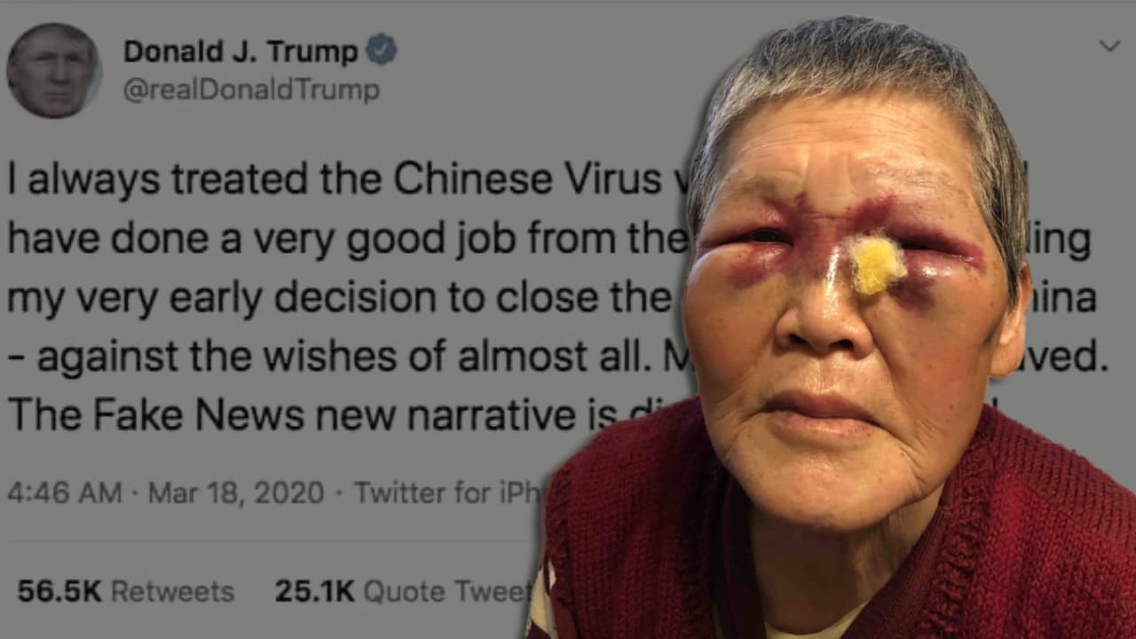 Recaudan casi $900,000 para asiática de 75 años que envió a su agresor al hospital