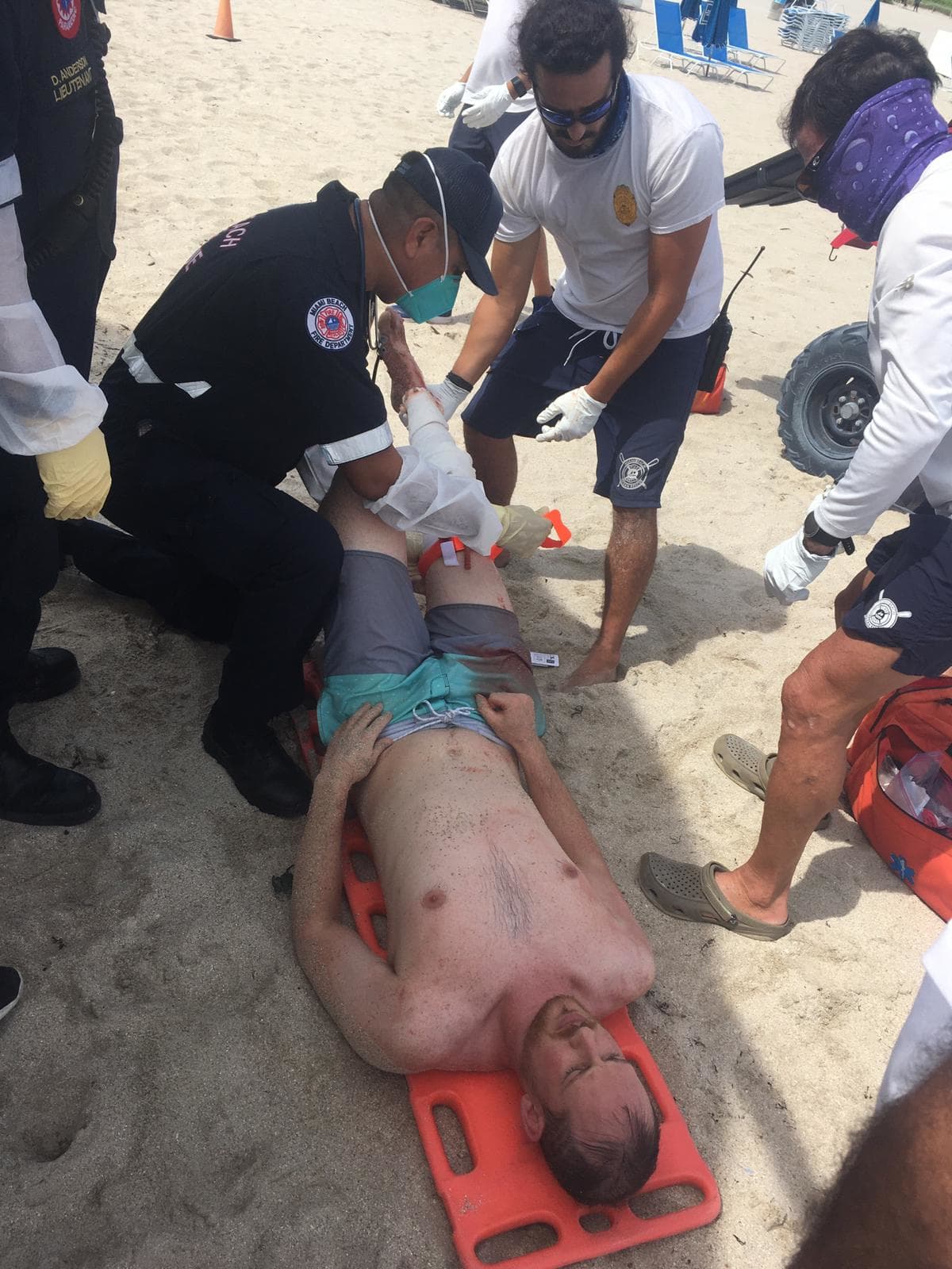 Pero al salir del agua, él y su novia se sorprendieron al ver el pedazo que le faltaba a su pierna. 
<br>