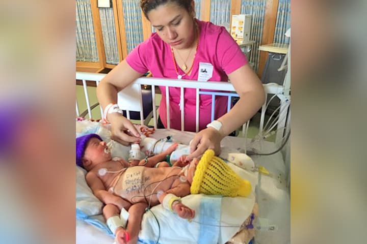 Primera vez de Silvia Hernández con sus hijas siamesas Scarlet y Ximena.