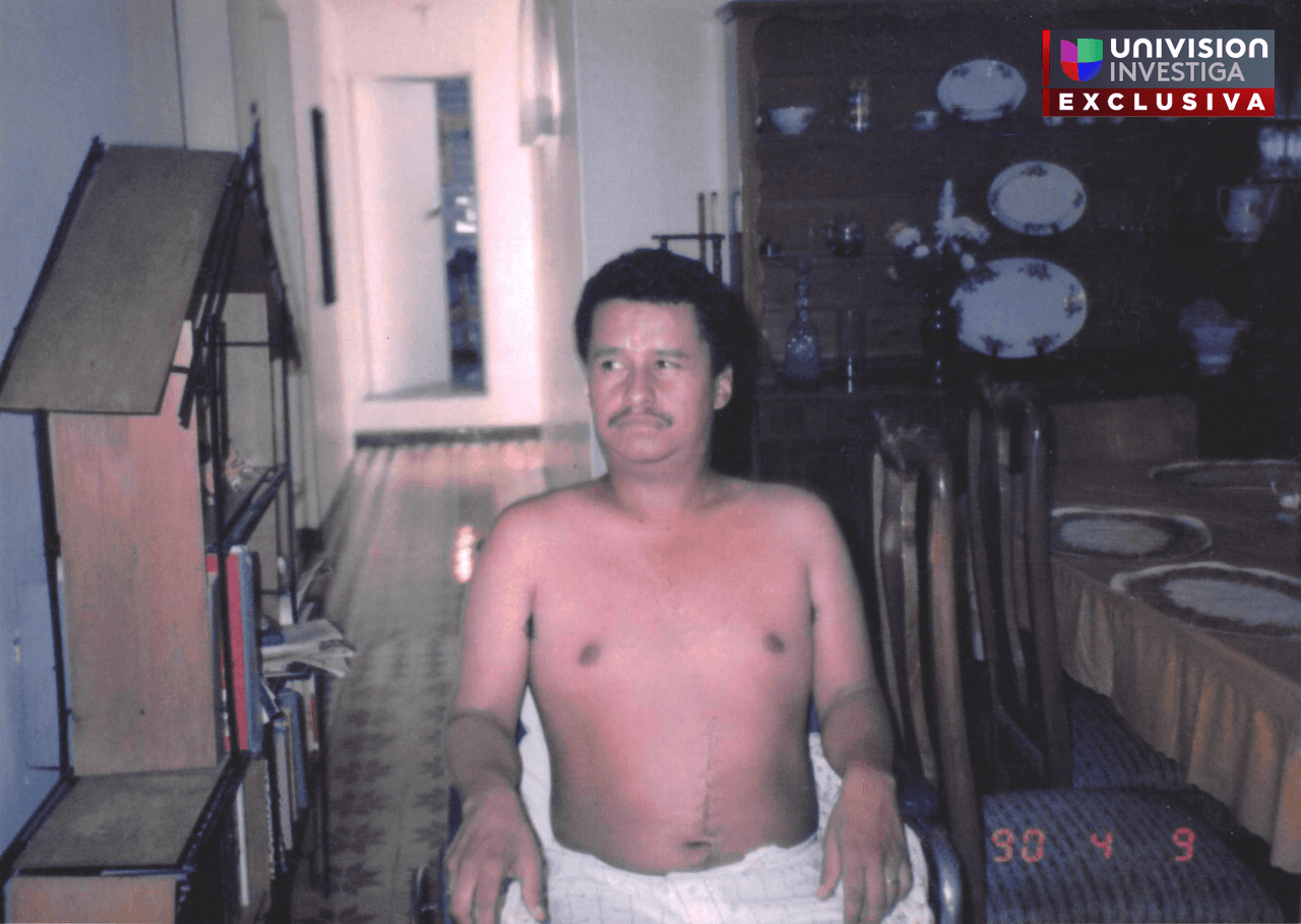 Abril 9 de 1990. Darío Uzma en su casa de Medellín después del atentado. Una cicatriz de la cirugía a la que fue sometido en la clínica Soma atraviesa verticalmente su abdomen.
