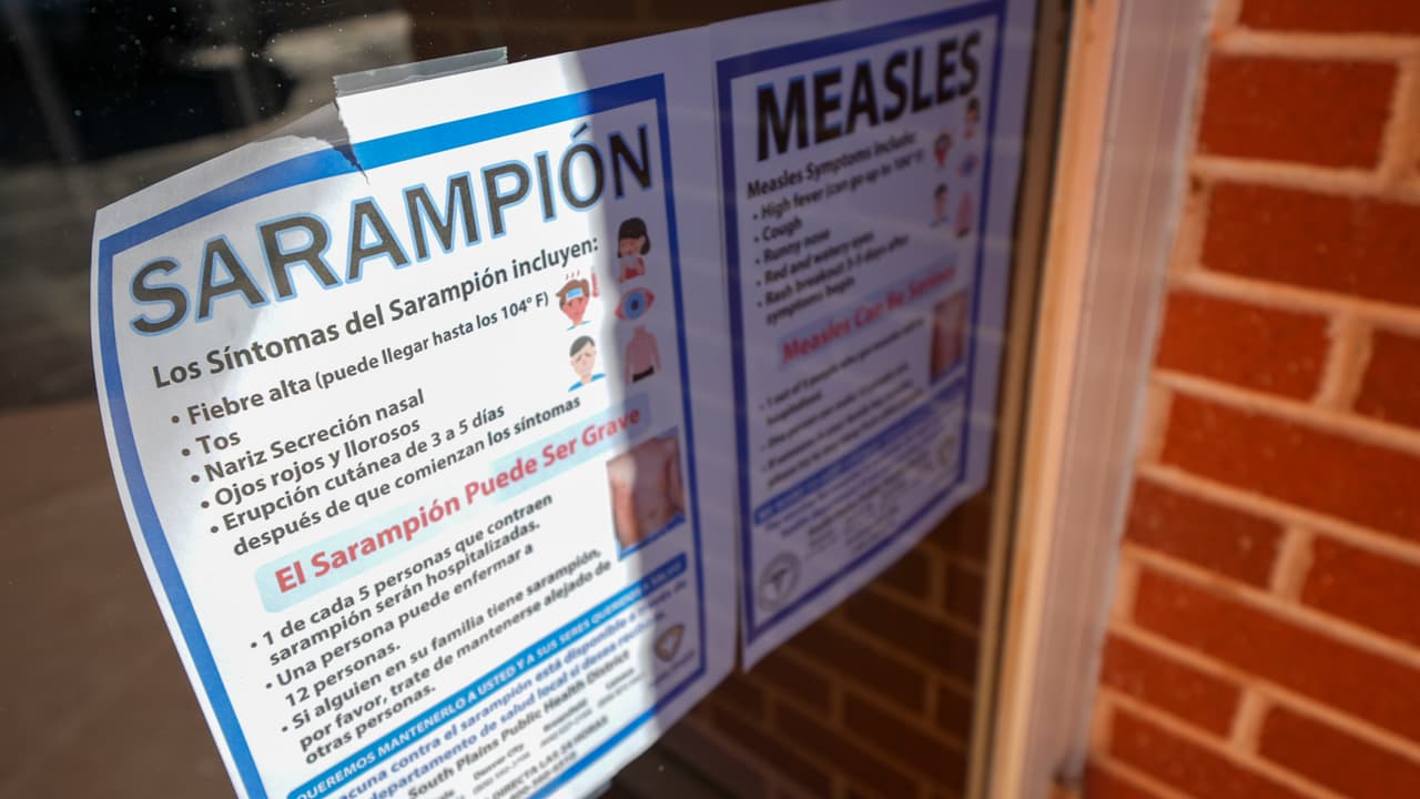 Niño con sarampión viajó por DC, Maryland y Virginia, alertan autoridades
