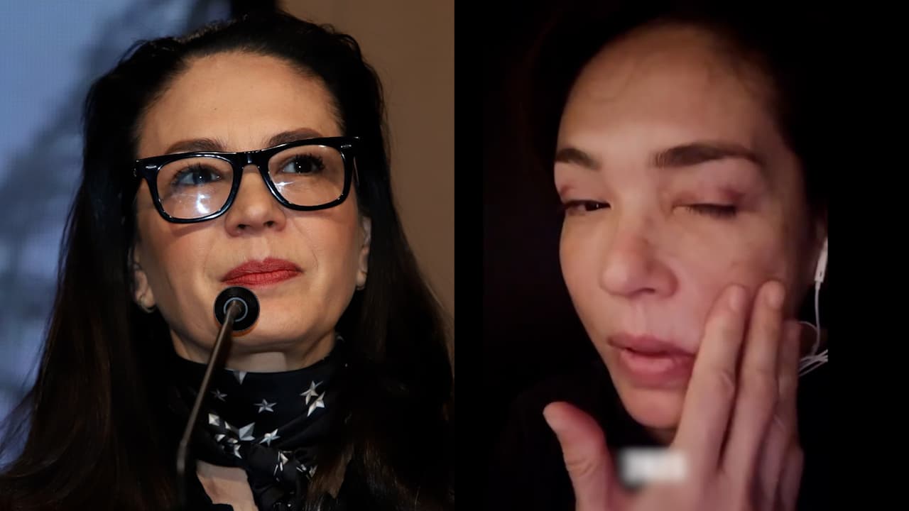 Yolanda Andrade muestra el paso de su enfermedad y daño que le ha dejado en el rostro
