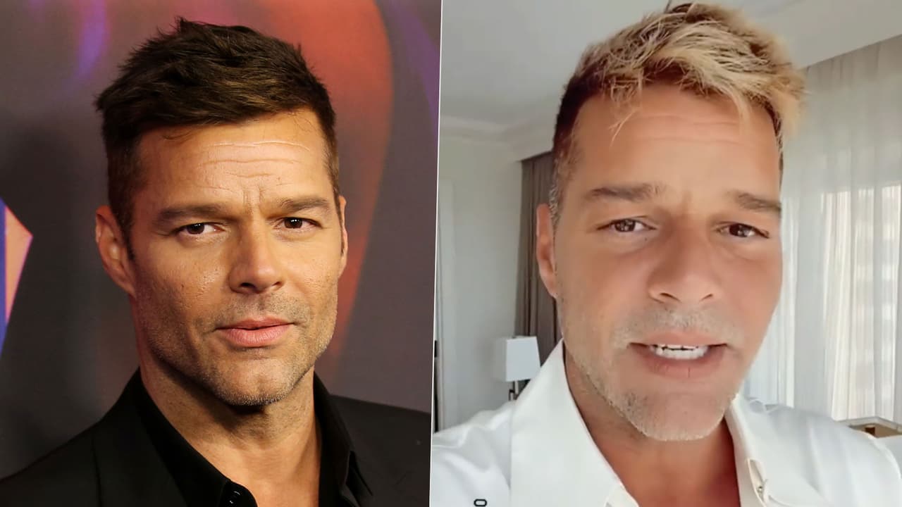 <h3 class="cms-H3-H3">Ricky Martín </h3>
<br>
<br>El cantante puertorriqueño Ricky Martin, sorprendió en sus redes sociales cuando mostró una foto donde se ve con su cara perfilada. Ricky se realizó una intervención estética llamada bichectomía, se trata de una cirugía que afina un poco las mejillas y acentuar de esa manera los pómulos. En otras oportunidades, Ricky fue señalado de haberse hecho una cirugía de labios. El artista comparte con sus seguidores algunos de sus secretos alimenticios y de salud.