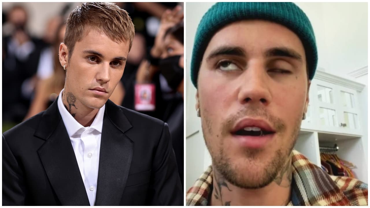 Justin Bieber revela que sufre parálisis facial debido a una enfermedad infecciosa 
