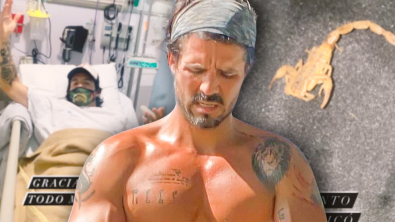 "No se siente nada chido": el actor José Ron fue a parar al hospital porque lo picó un alacrán