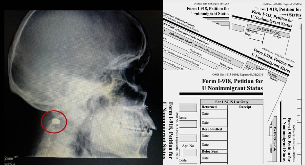 Cuando una bala en la cabeza duele menos que la espera por la Visa U