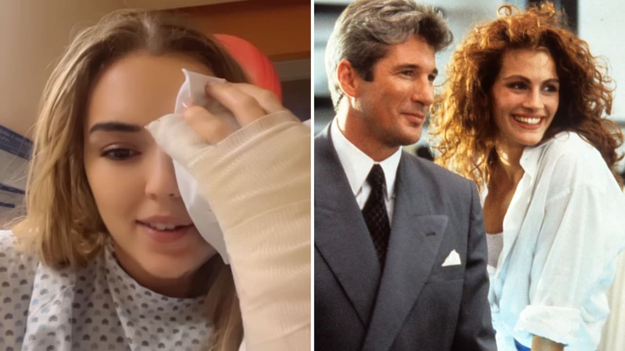 Protagonista de ‘Pretty Woman’ sufre grave accidente en pleno escenario: este es su estado de salud 