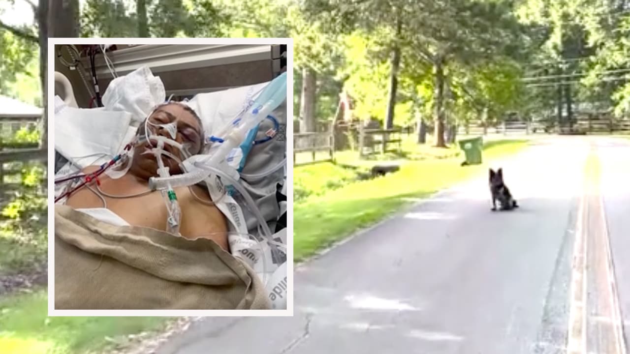 Nicolás Vásquez pierde sus piernas tras ataque de perros pitbull en el norte de Houston