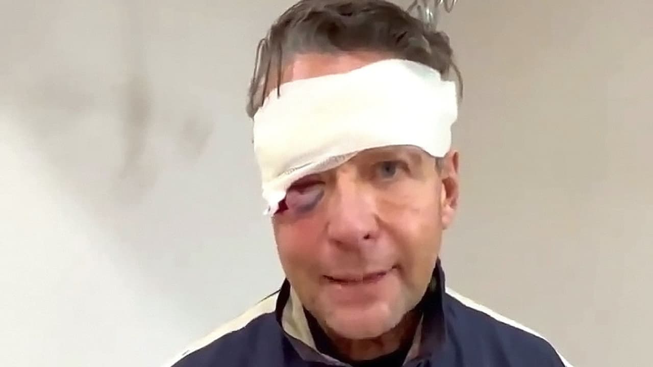 Alfredo Adame otorgó el perdón a quienes lo golpearon y le dejaron daños en un ojo