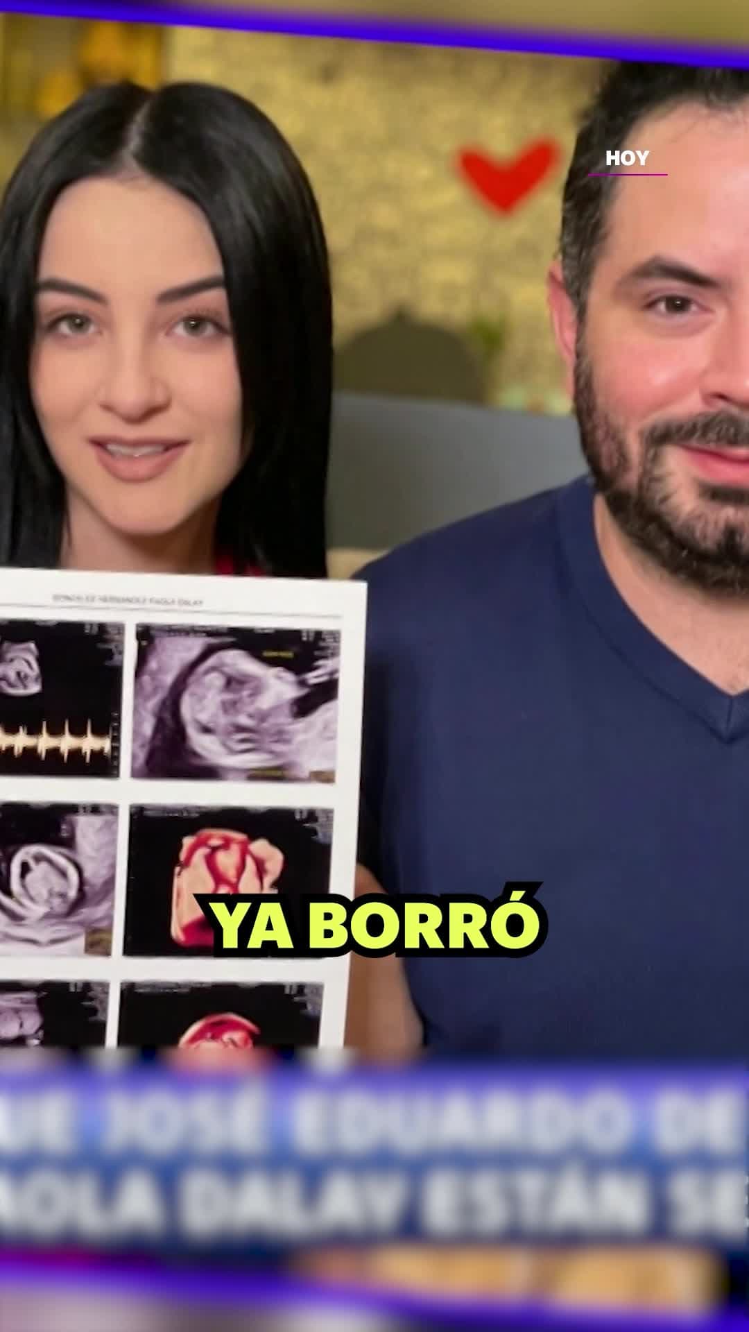¿José Eduardo Derbez y Paola Dalay están separados?