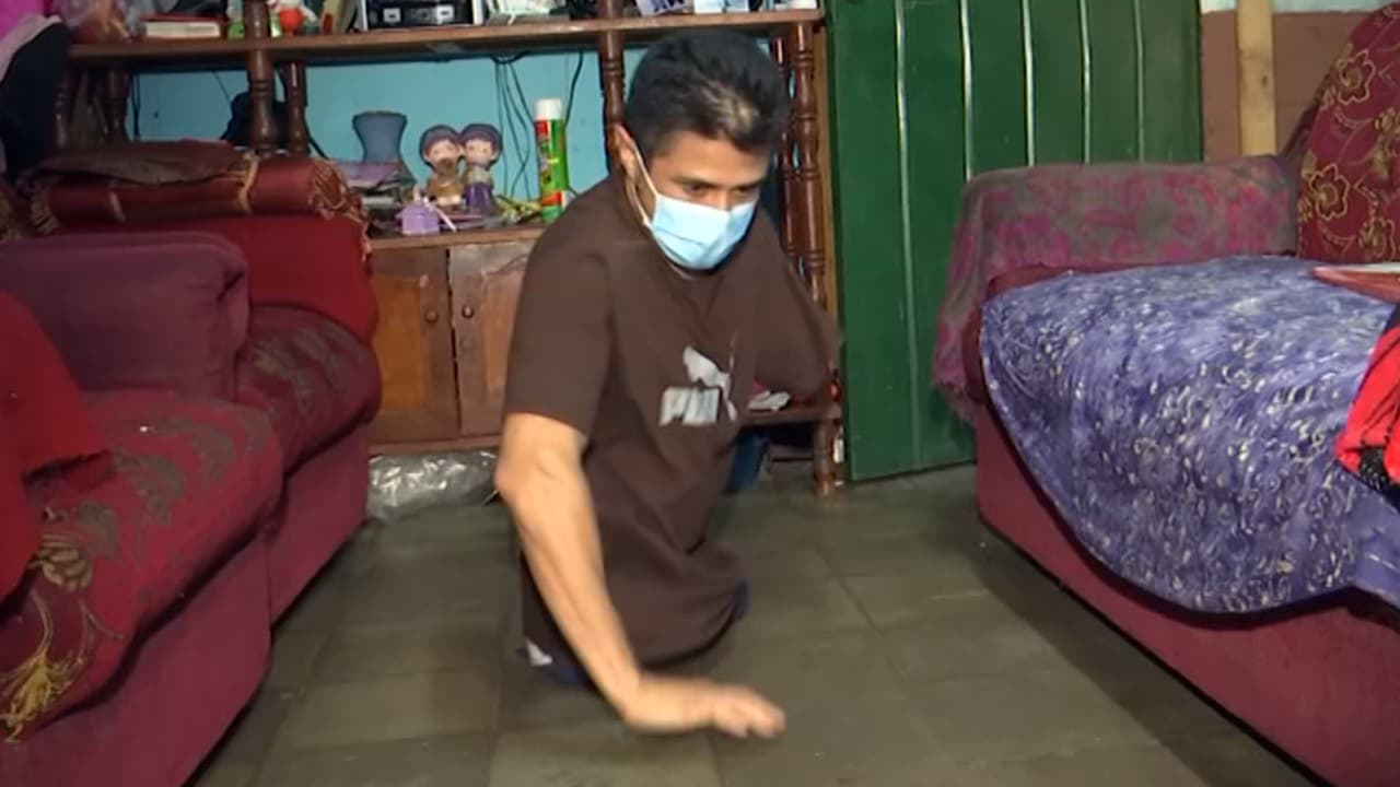 Necesita ayuda: perdió sus piernas y un brazo en un accidente en Los Ángeles