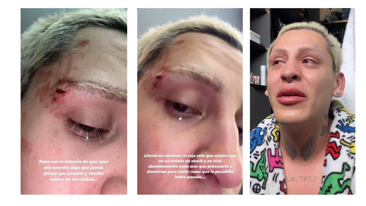 Kunno denunció el ataque en sus redes.