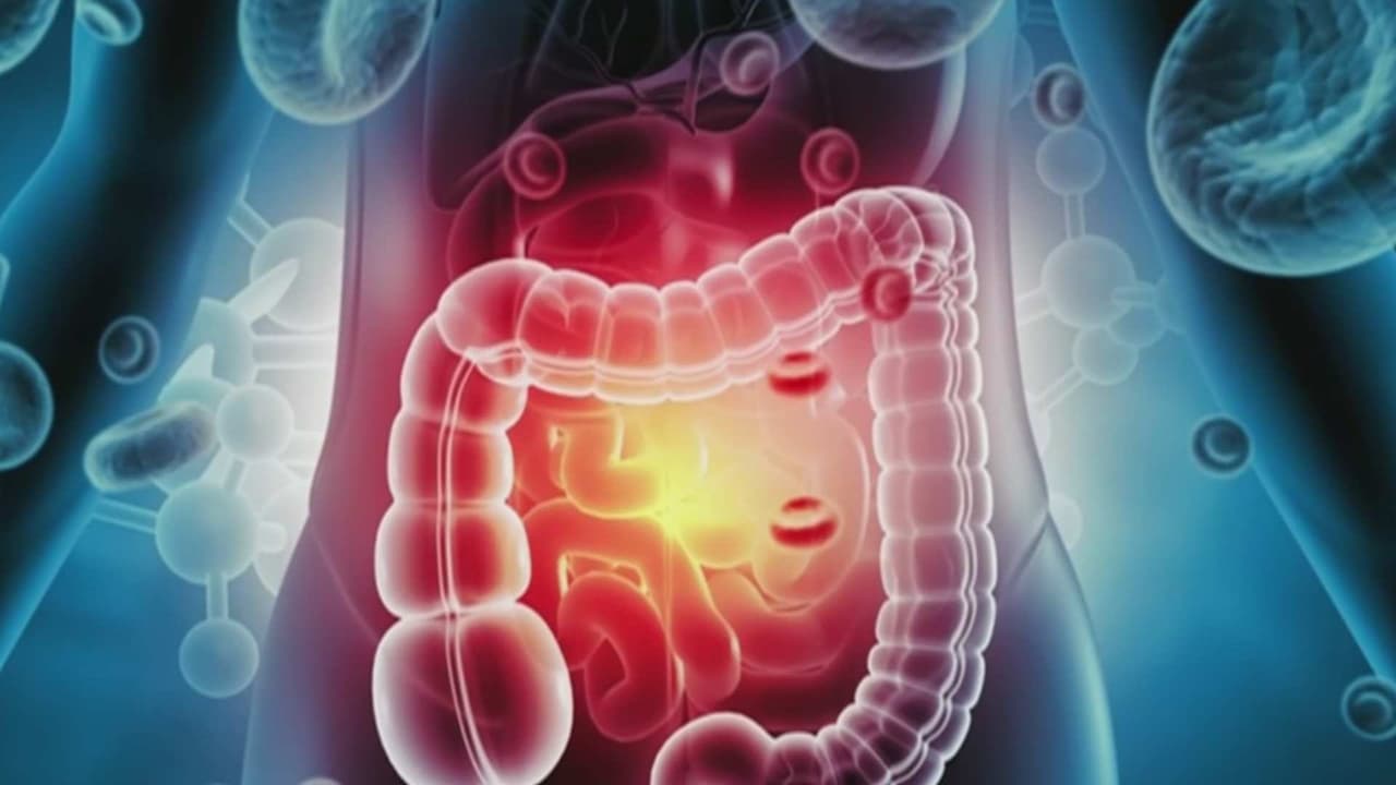 Nuevas pruebas de sangre facilitan la detección del cáncer colorrectal