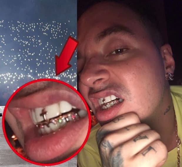 Previo a los diamantes, Balvin usó esta cruz de oro entre los dientes superiores y adornó los inferiores con una delgada placa.