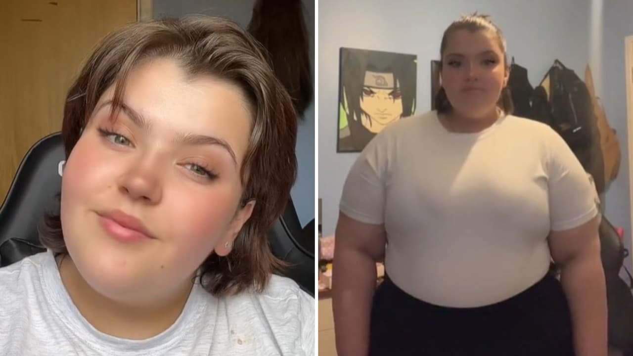 Muere a los 20 años ‘tiktoker’ Morgan Ribeiro tras someterse a cirugía de manga gástrica 