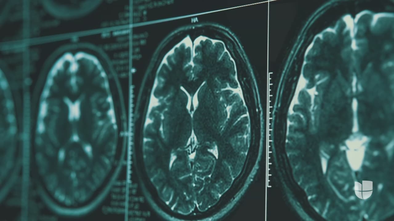 ¿Cuáles son los primeros signos del Alzheimer? Diagnóstico del piloto del "milagro en el Hudson" crea conciencia