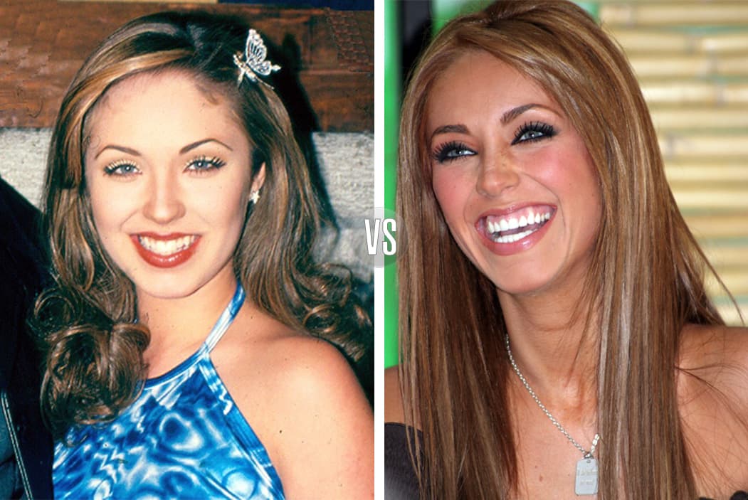 ¡Cambiazo! Anahí tampoco pudo con sus dientes y prefirió hacerse un arreglito que luego derivó en muchas otras cosas.