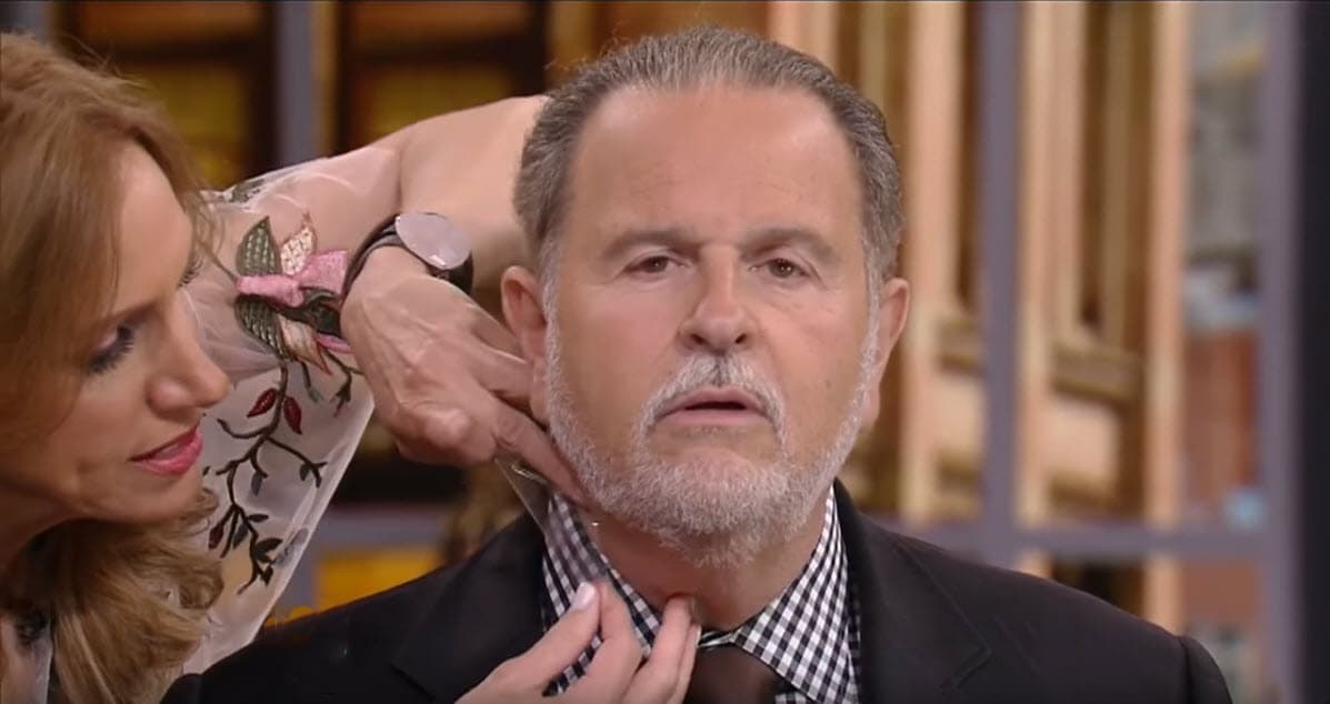 Con cinta adhesiva transparente, la Flaca logró restirar su piel para esconder el exceso.