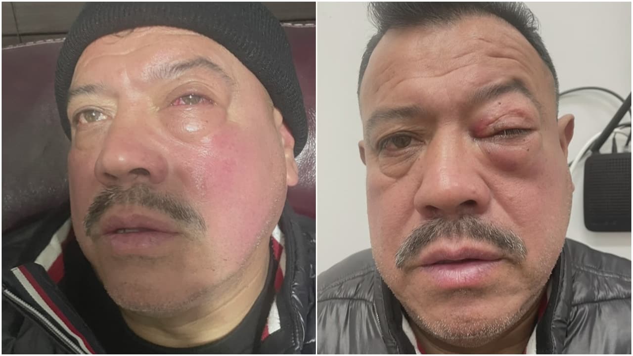 Vendedor ambulante denuncia que ha sido asaltado hasta seis veces por menores de edad: “es una frustración”