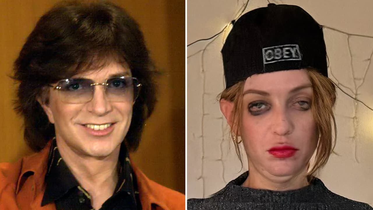 Hijo de Camilo Sesto muestra su transformación: alerta por heridas en su cuerpo