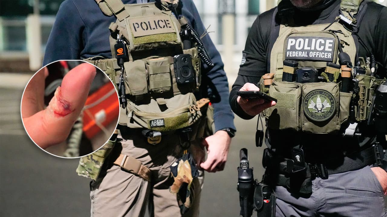 Un hombre muerde a un agente de ICE durante su arresto en Los Ángeles y le fractura un dedo