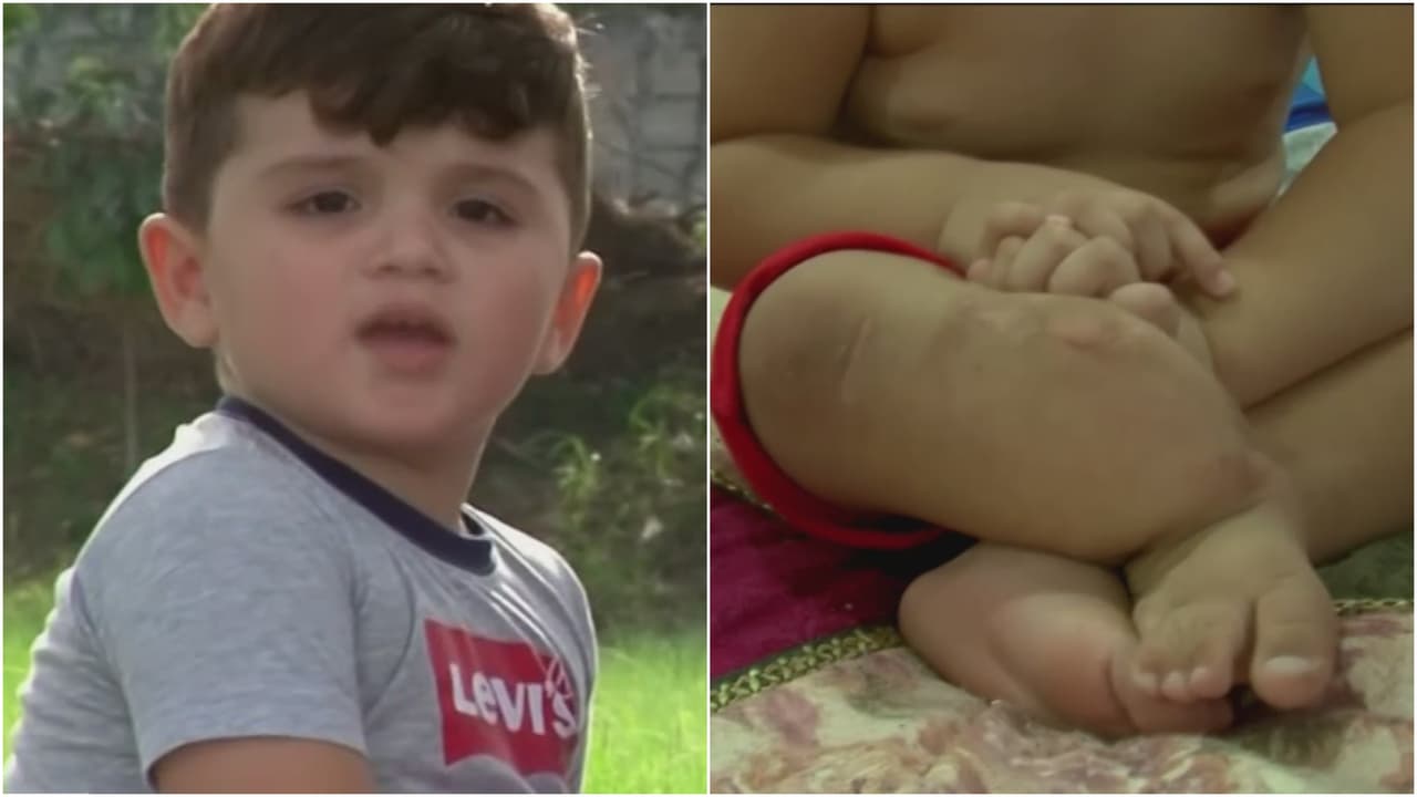 Santiago es un niño hondureño de 3 años. Su madre, entre lágrimas, pide ayuda para que su hijo pueda tener un tratamiento médico.
<b><a href="https://www.univision.com/shows/primer-impacto/ayuda-de-impacto-nino-tiene-una-malformacion-en-su-pierna-derecha-en-honduras" target="_blank"> Clic aquí para conocer cómo ayudarlo</a></b>.