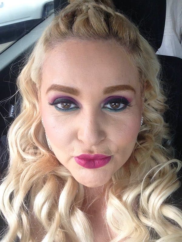 El primer procedimiento al que Sheyla se sometió fue en 2008, se trató de una cirugía bariátrica para ayudar a su metabolismo y con la que logró bajar 20 libras (9 kilos).