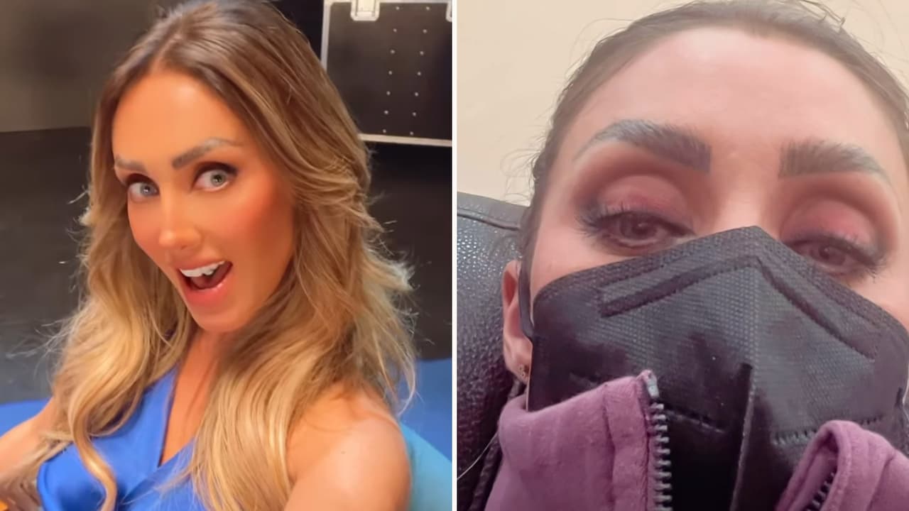 Anahí sufre accidente y acaba de emergencia en el hospital: quedó en "shock"