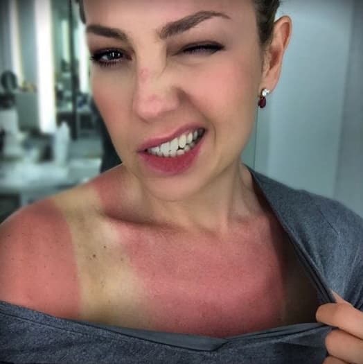 Thalía hace de todo para estar bella, aunque a veces se le pase la mano. Así es, si creías que este bronceado era perfecto, mira como quedó la cantante en una ocasión que quiso desafiar al sol.