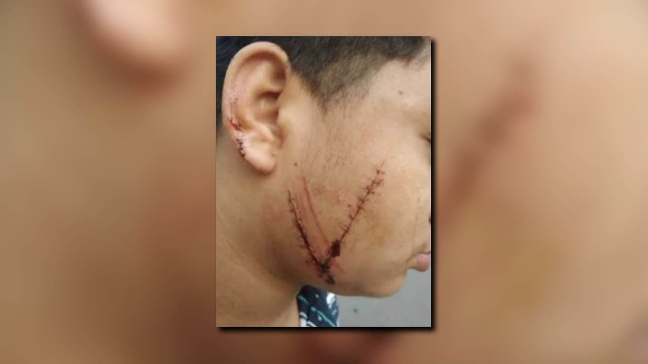 El menor de edad resultó herido en una pelea en la escuela